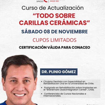"TODO SOBRE CARILLAS CERÁMICAS"