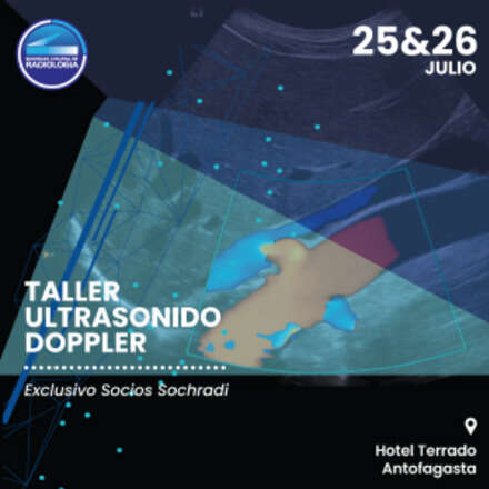 Taller Ultrasonido Doppler